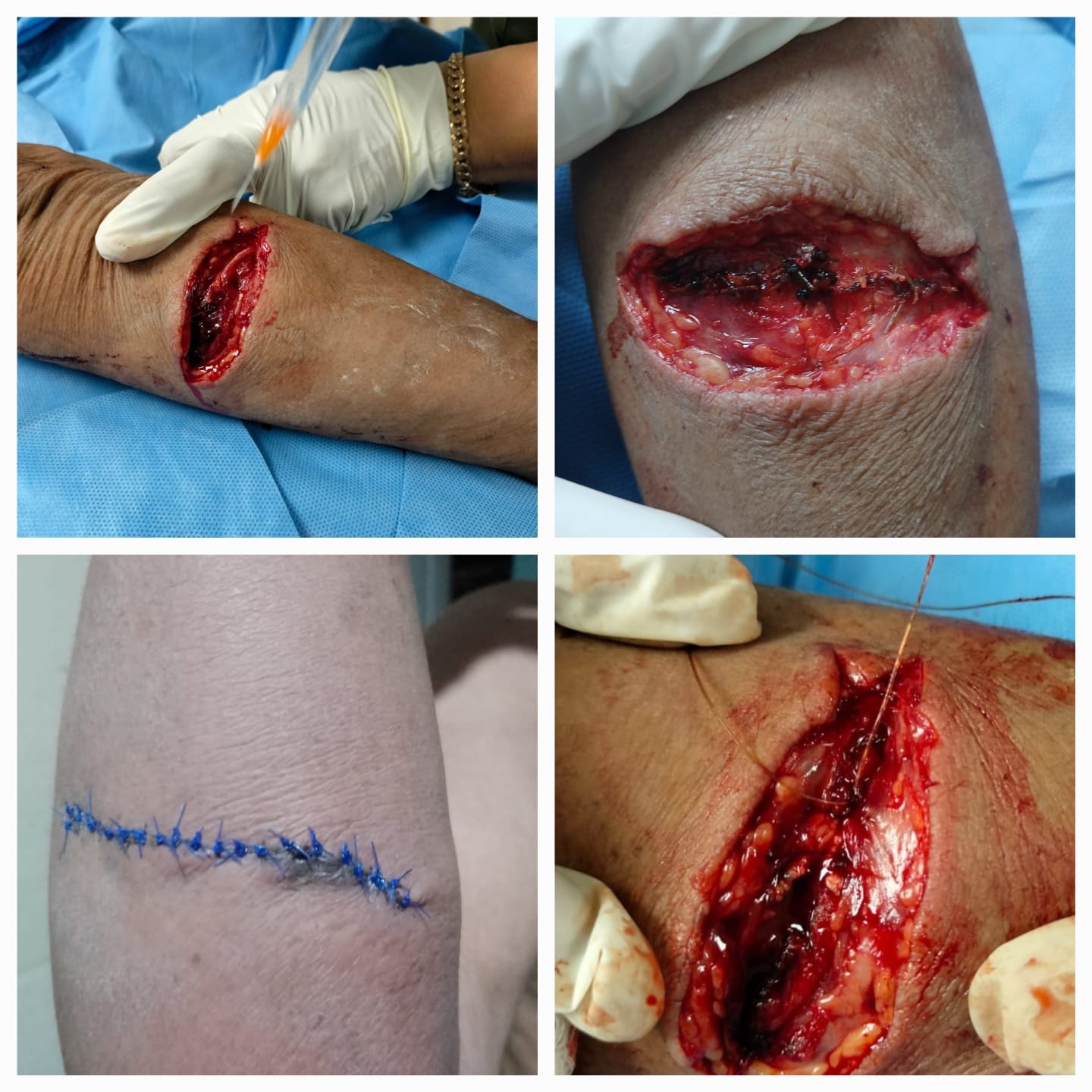 Evidencia de procedimiento médico