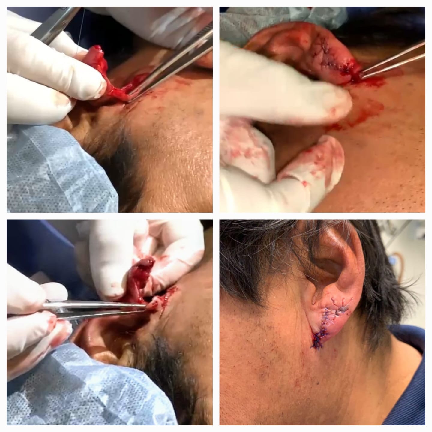 Evidencia de procedimiento médico