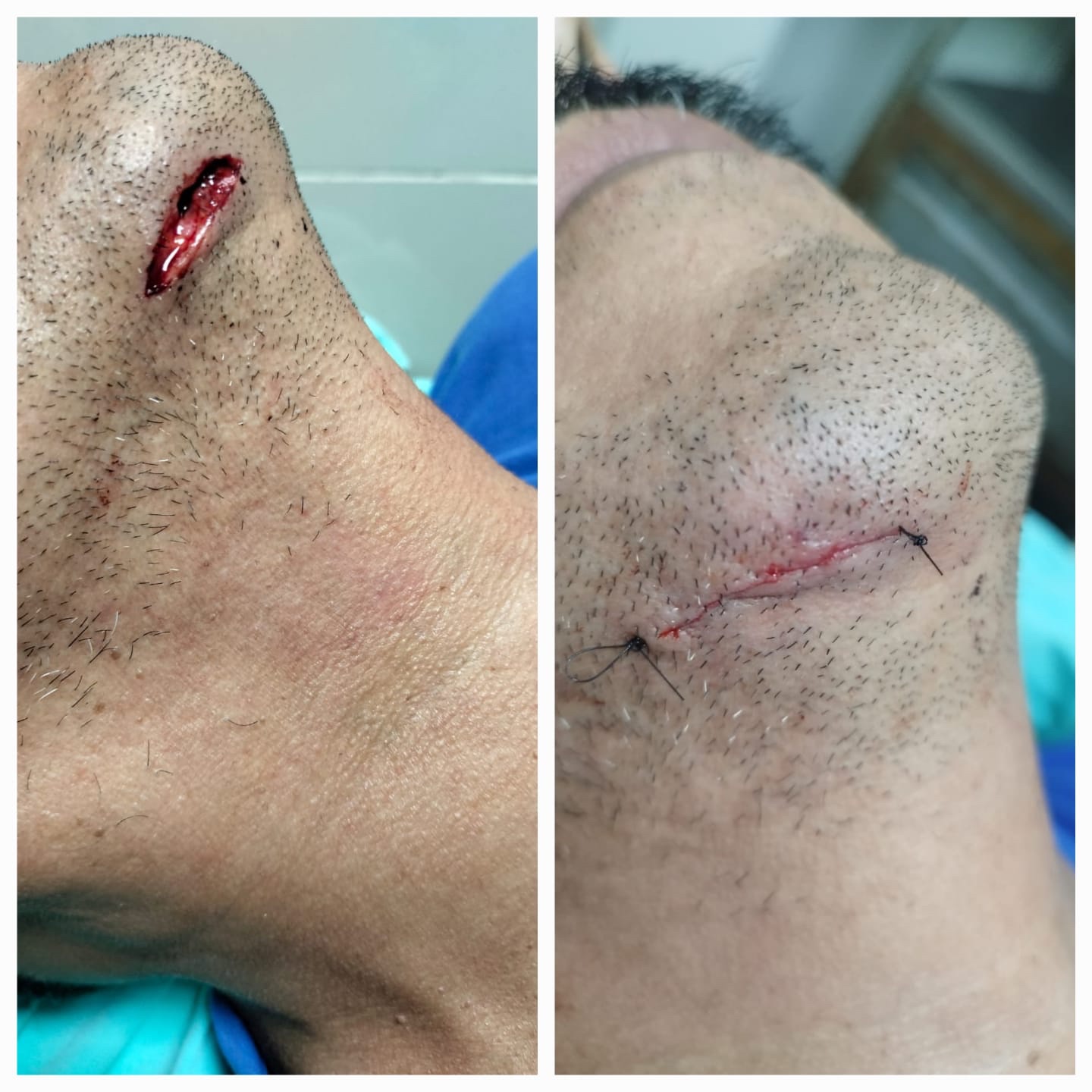 Evidencia de procedimiento médico
