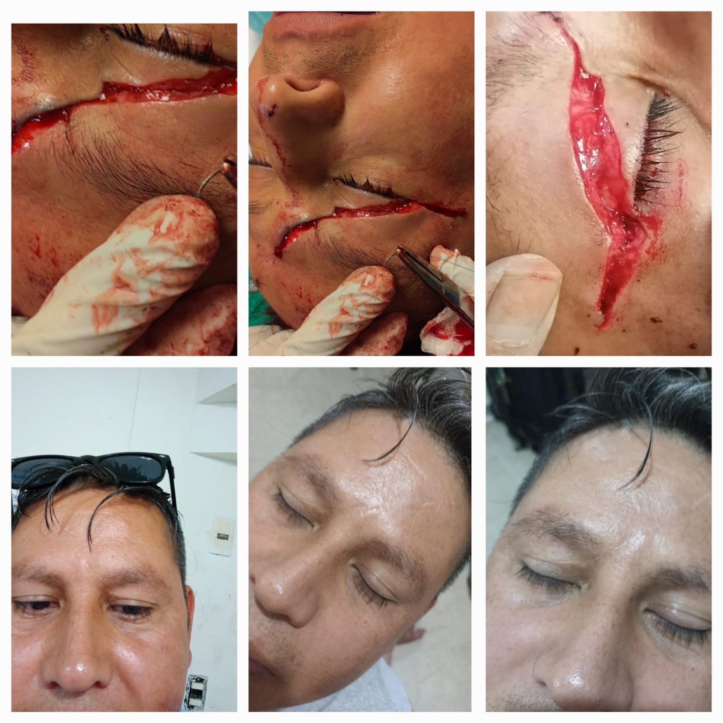 Evidencia de procedimiento médico